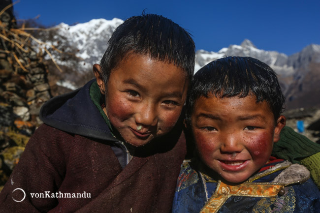 Snotty nose and chapped cheeks are normal for people living in high elevations, esp kids